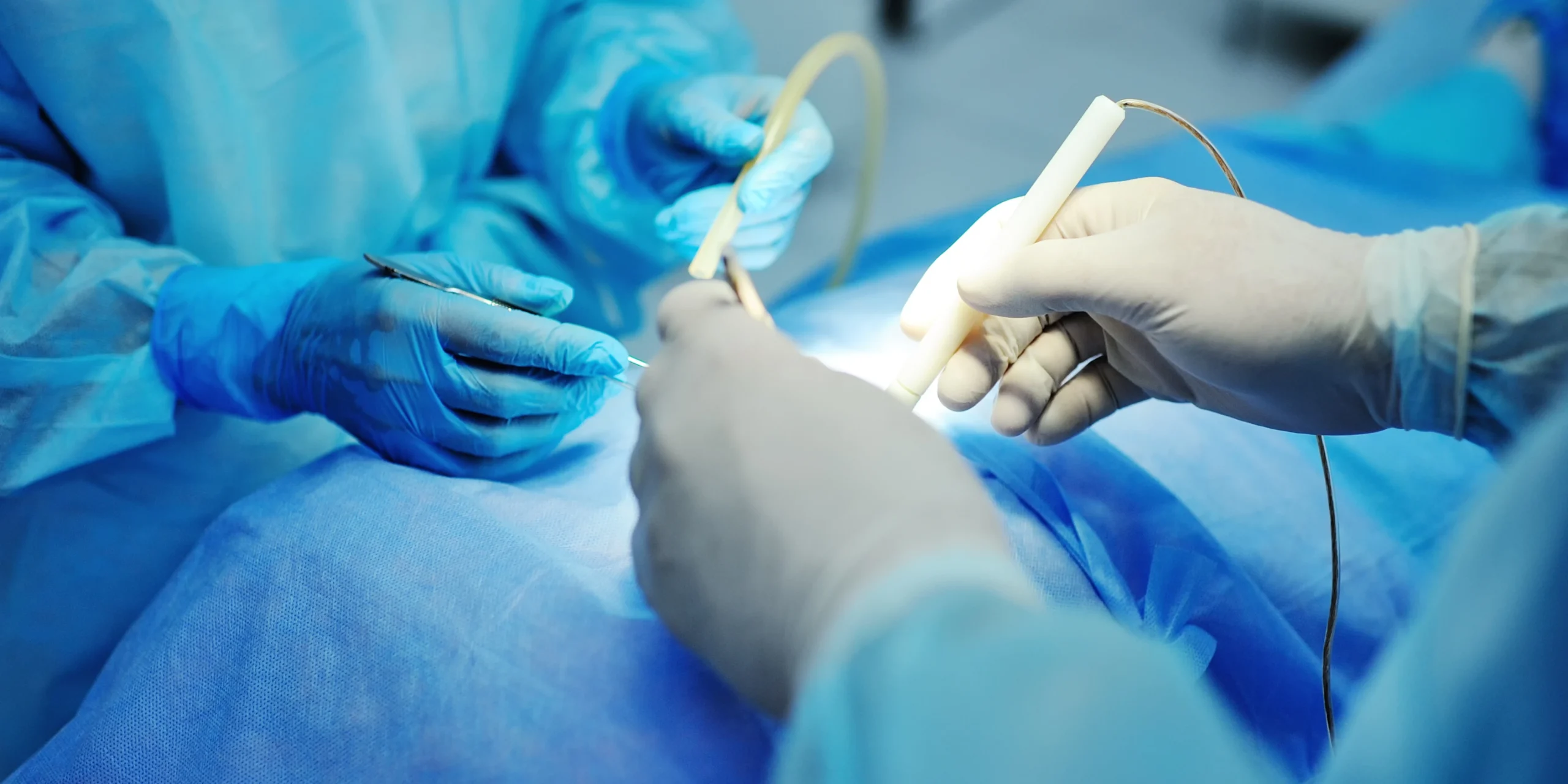 laproscopic-surgery